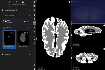 Яндекс представил нейросеть для выявления ДЦП у новорожденных